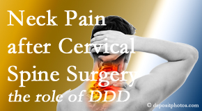 Poulin Chiropractic of Herndon and Ashburn offers gentle treatment for neck pain after neck surgery.