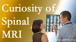 Ashburn MRIs for spinal stenosis may be revealing…or puzzling.