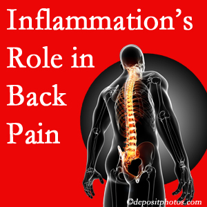 The role of inflammation in Ashburn back pain is real. Chiropractic care can manage it.