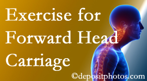 Ashburn chiropractic treatment of forward head carriage is two-fold: manipulation and exercise.