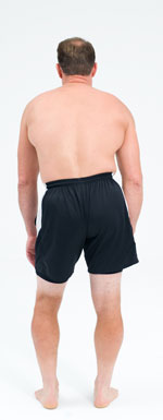 sciatic lean away from side of pain