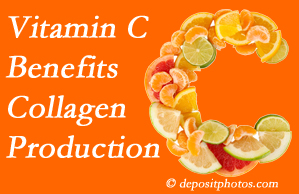Ashburn chiropractic offers tips on nutrition like vitamin C for boosting collagen production that decreases in musculoskeletal conditions.