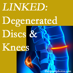 Degenerated discs and degenerated knees are not such strange bedfellows. They are seen to be related. Ashburn patients with a loss of disc height due to disc degeneration often also have knee pain related to degeneration.  