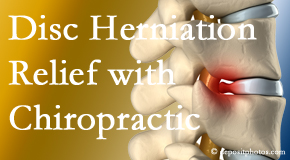 Poulin Chiropractic of Herndon and Ashburn gently treats the disc herniation causing back pain. 