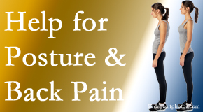 Poor posture and back pain are linked and find help and relief at Poulin Chiropractic of Herndon and Ashburn.