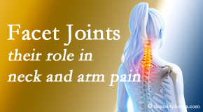 Poulin Chiropractic of Herndon and Ashburn thoroughly examines, diagnoses, and treats cervical spine facet joints for neck pain relief when they are involved.