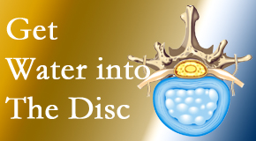 Poulin Chiropractic of Herndon and Ashburn uses spinal manipulation and exercise to enhance the diffusion of water into the disc which helps the health of the disc.