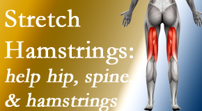 Poulin Chiropractic of Herndon and Ashburn encourages back pain patients to stretch hamstrings for length, range of motion and flexibility to support the spine.