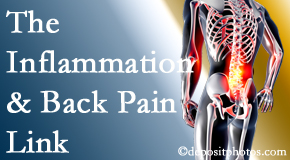 Poulin Chiropractic of Herndon and Ashburn addresses the inflammatory process that accompanies back pain as well as the pain itself.