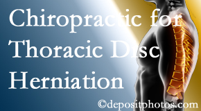 Poulin Chiropractic of Herndon and Ashburn diagnoses and treats thoracic disc herniation pain and relieves its symptoms like unexplained abdominal pain or other gastrointestinal issues. 