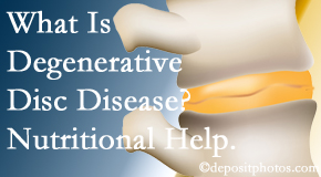 Poulin Chiropractic of Herndon and Ashburn takes care of degenerative disc disease with chiropractic treatment and nutritional interventions.