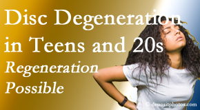 Poulin Chiropractic of Herndon and Ashburn manages back pain due to disc degeneration in younger people in their teens and 20s.