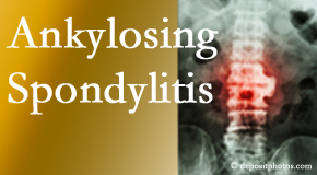 Ankylosing spondylitis is gently cared for by your Ashburn chiropractor.