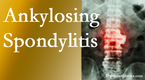 Ankylosing spondylitis is gently cared for by your Ashburn and Herndon chiropractor.