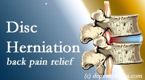 Poulin Chiropractic of Herndon and Ashburn offers non-surgical treatment for relief of disc herniation related back pain. 