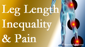 Poulin Chiropractic of Herndon and Ashburn checks for leg length inequality as it is related to back, hip and knee pain issues.