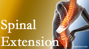 Poulin Chiropractic of Herndon and Ashburn understands the role of extension in spinal motion, its necessity, its benefits and potential harmful effects. 
