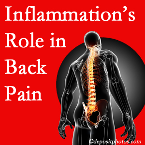 The role of inflammation in Ashburn and Herndon back pain is real. Chiropractic care can manage it.