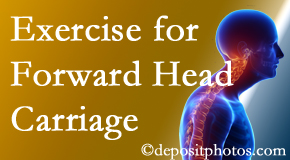 Ashburn and Herndon chiropractic treatment of forward head carriage is two-fold: manipulation and exercise.
