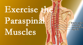 Poulin Chiropractic of Herndon and Ashburn describes the importance of paraspinal muscles and their strength for Ashburn and Herndon back pain relief.