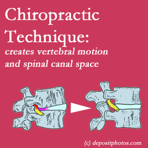 picture of a Ashburn spinal stenotic canal