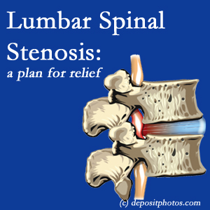 picture of Ashburn and Herndon lumbar spinal stenosis 