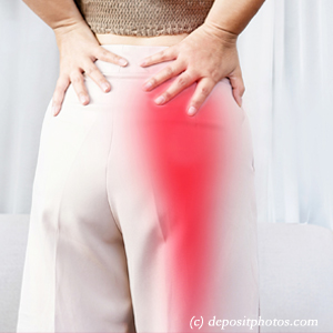 picture of Ashburn leg pain, sciatica, lumbar radiculopathy