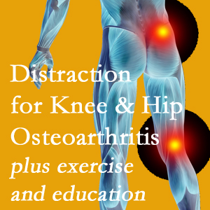 A chiropractic treatment plan for Ashburn knee pain and hip pain caused by osteoarthritis: education, exercise, distraction.