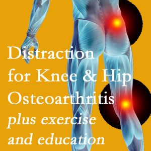 A chiropractic treatment plan for Ashburn and Herndon knee pain and hip pain due to osteoarthritis: education, exercise, distraction.