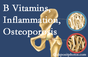 Ashburn and Herndon chiropractic care of osteoporosis often comes with nutritional tips like b vitamins for inflammation reduction and for prevention.