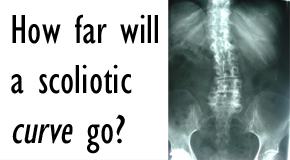 picture of scoliosis