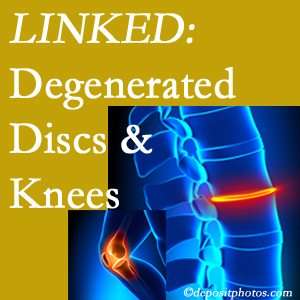 Degenerated discs and degenerated knees are not such strange bedfellows. They are seen to be related. Ashburn and Herndon patients with a loss of disc height due to disc degeneration often also have knee pain related to degeneration. 
