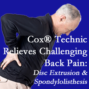 Ashburn chiropractic care with Cox Technic relieves back pain due to a painful combination of a disc extrusion and a spondylolytic spondylolisthesis.