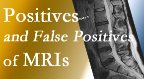 Poulin Chiropractic of Herndon and Ashburn carefully decides when and if MRI images are needed to guide the Ashburn and Herndon chiropractic treatment plan. 